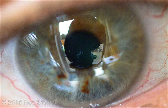 035-110115_Eyeball
